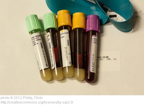 How much do lab tests cost: $9 or $275 with insurance? Or, how to shop for health care